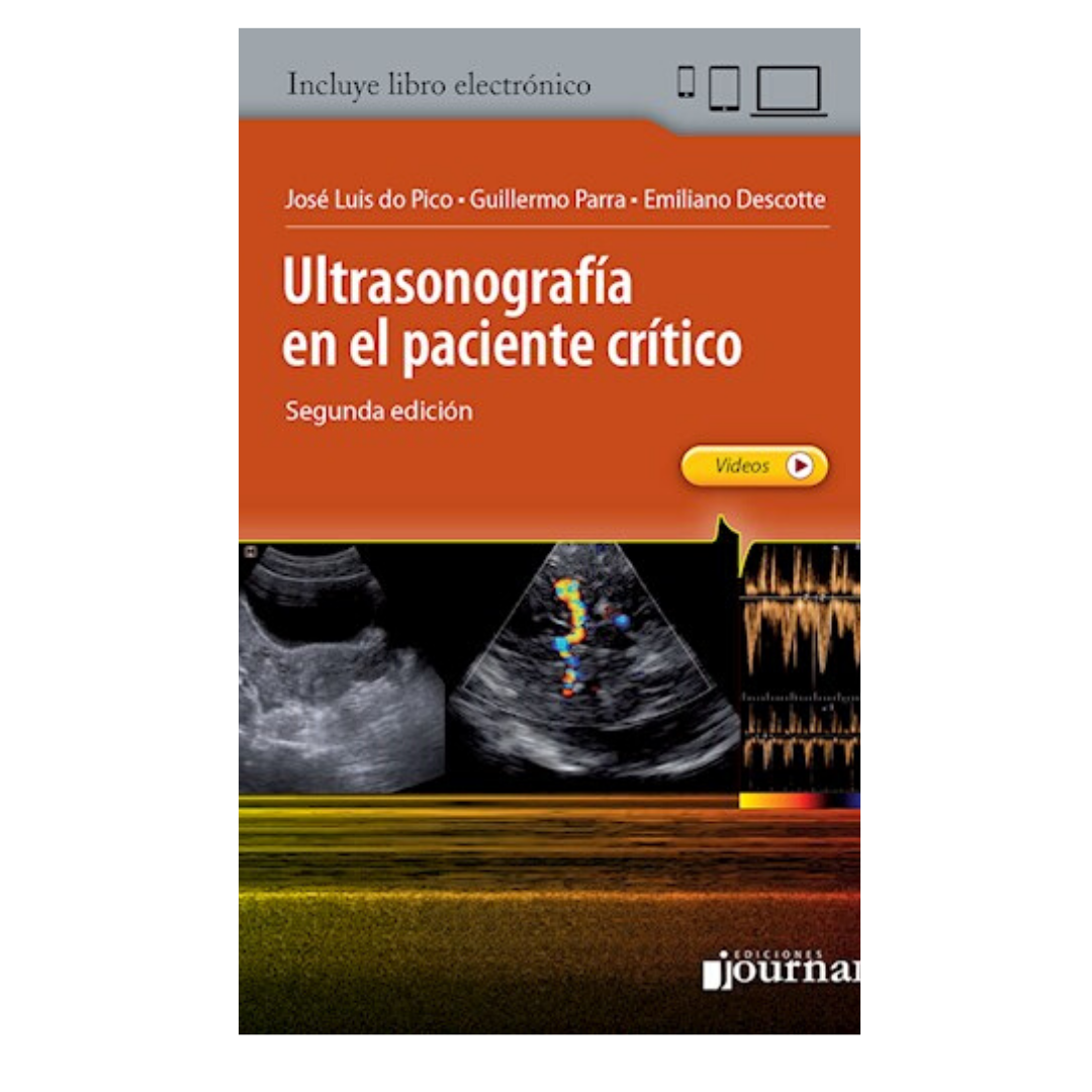 Ultrasonografía