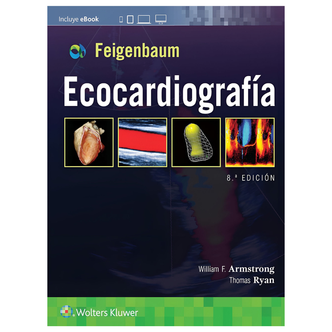 ECOCARDIOGRAFIA DE FEIGENBAUM
