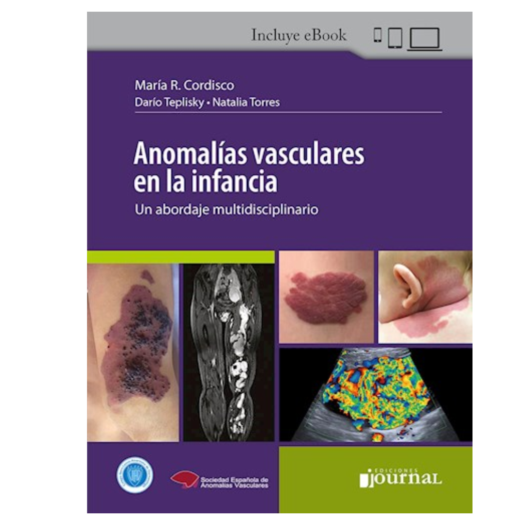 Anomalías Vasculares en la Infancia